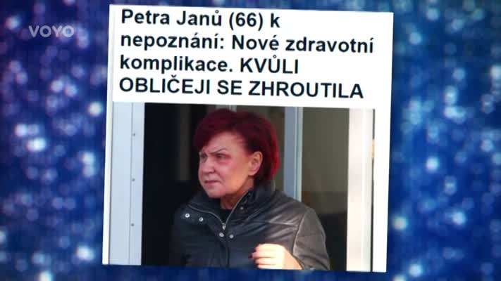 VIDEO: Nepovedená plastika nebo nemoc? Co může za jiný vzhled Petry Janů?