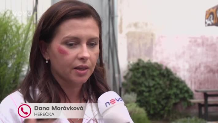 Jak se natáčely násilné scény v Ulici a Ordinaci? Padla skutečná facka! Herečky se podělily o detaily