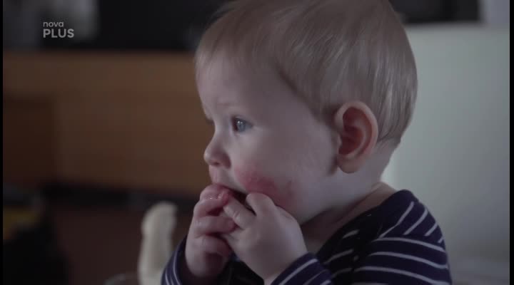 MAMINY S ROZUMEM: Mýty a fakta o atopickém ekzému – 74. Díl